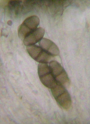 spores brunes  1 cloison, 10-20 x 5-10 m
