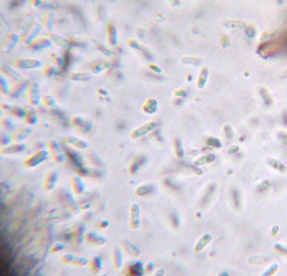 conidies bacilliformes 3-5 x 1-1,5 µm