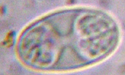 spore polariloculaire (Caloplaca)