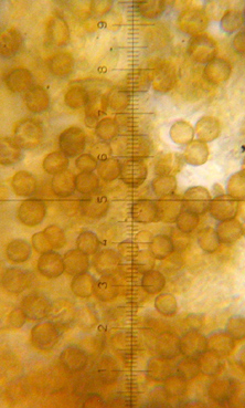 spores globuleuses, 3-8 µm