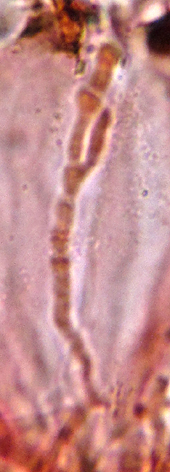 paraphyse isole ( rouge congo)