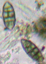spores, 4 par asque, devenant muriformes et brunes, 25-35 x 10-15 µm