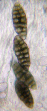 spores brunes, murales, 20-40 x 10-18 µm