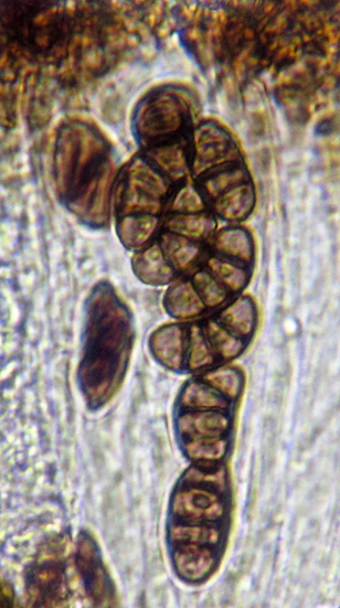 spores brunes, 14-21 x 6-11 m
