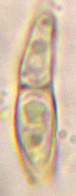 spores 11-20 x 3-7 µm, simples devenant cloisonnée [1(2)]