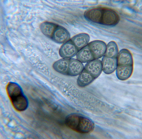 Spores bunes à 1 cloison, 13-18 x 7-10 µm