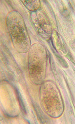 spores simples, incolores, 22-29 x 11-16 µm