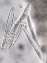 Spores incolores, 3 cloisons, 28-45 x 3-6 µm