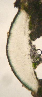 pithcium de l'apothcie verdtre (microscope)