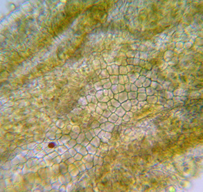 cortex vu au microscope (paraplectenchyme)