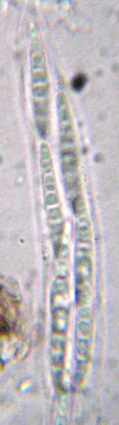 spores cloisonnes, 20-30 x 2,5-4 m