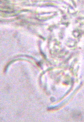 pycnidiospore en forme de lame de faucille