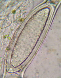 spore simple, incolore, 140-300 x 40-90 µm (2 par asque)