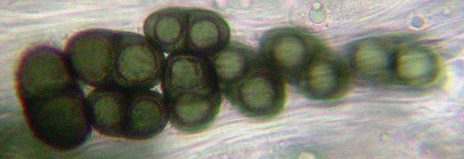 spores brunes  1 cloison, 27-28 x 13-20 m