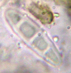 spore à 3 cloisons (22-30 x 4-6 µm)