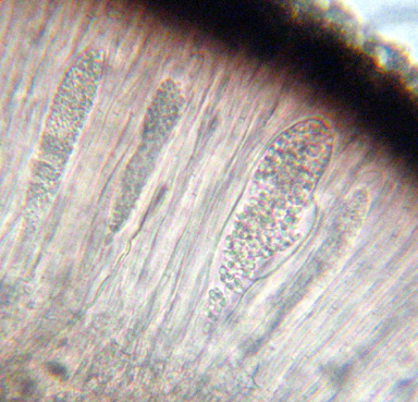 asques contenant de nombreuses spores (plus de 100 ? )